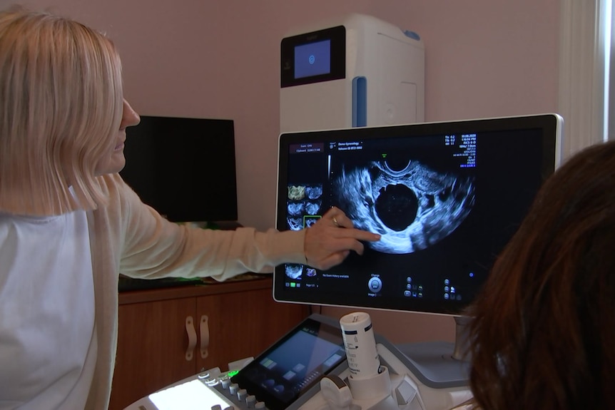 A woman points to a black circle on an ultrasound monitor