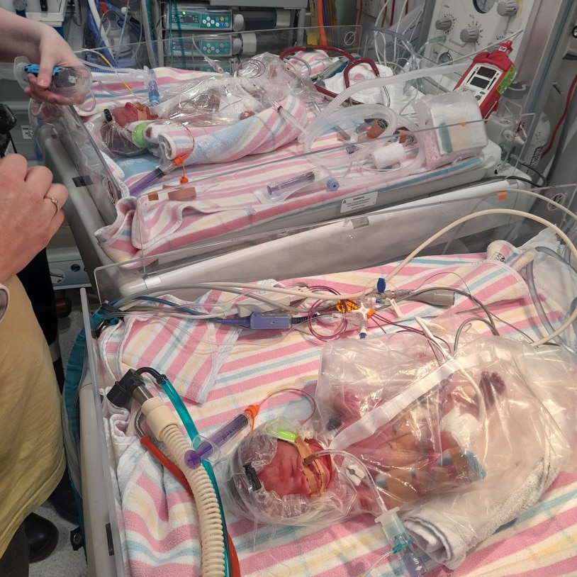 A photo of two premature babies in hospital bassinets surrounded by wires and monitors.