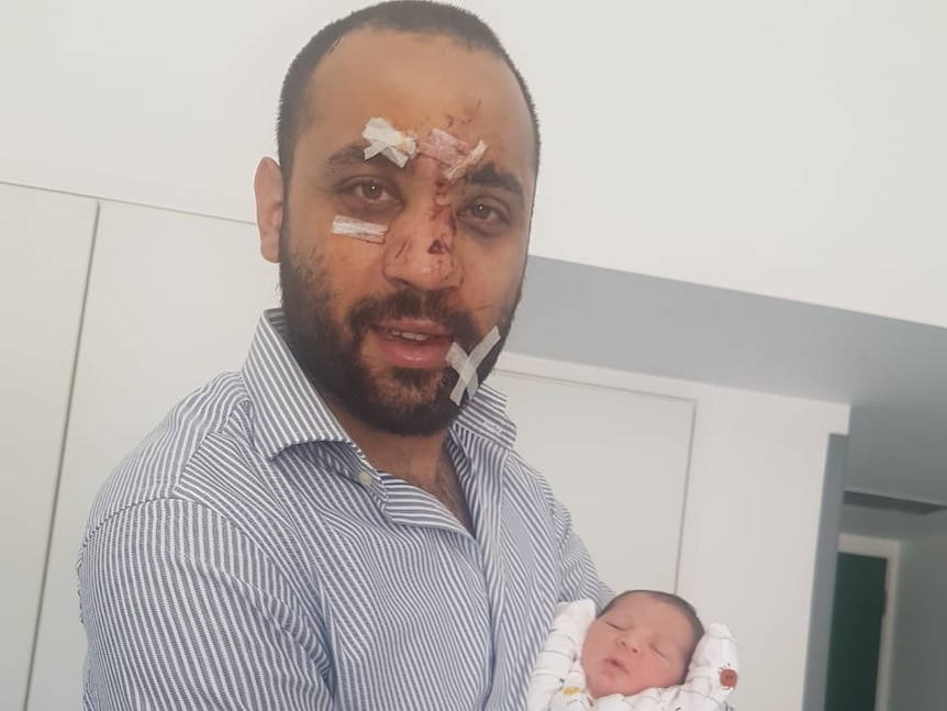 A man with cuts on his face and Band-Aids holds a baby as he smiles.