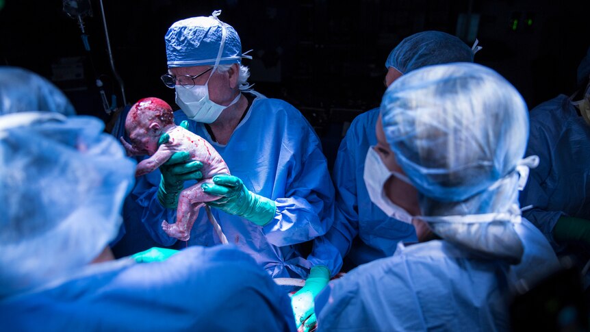 A baby being held up by a surgeon. Baby crying, umbilical cord still attached, surgical team in masks and blue surgical gowns