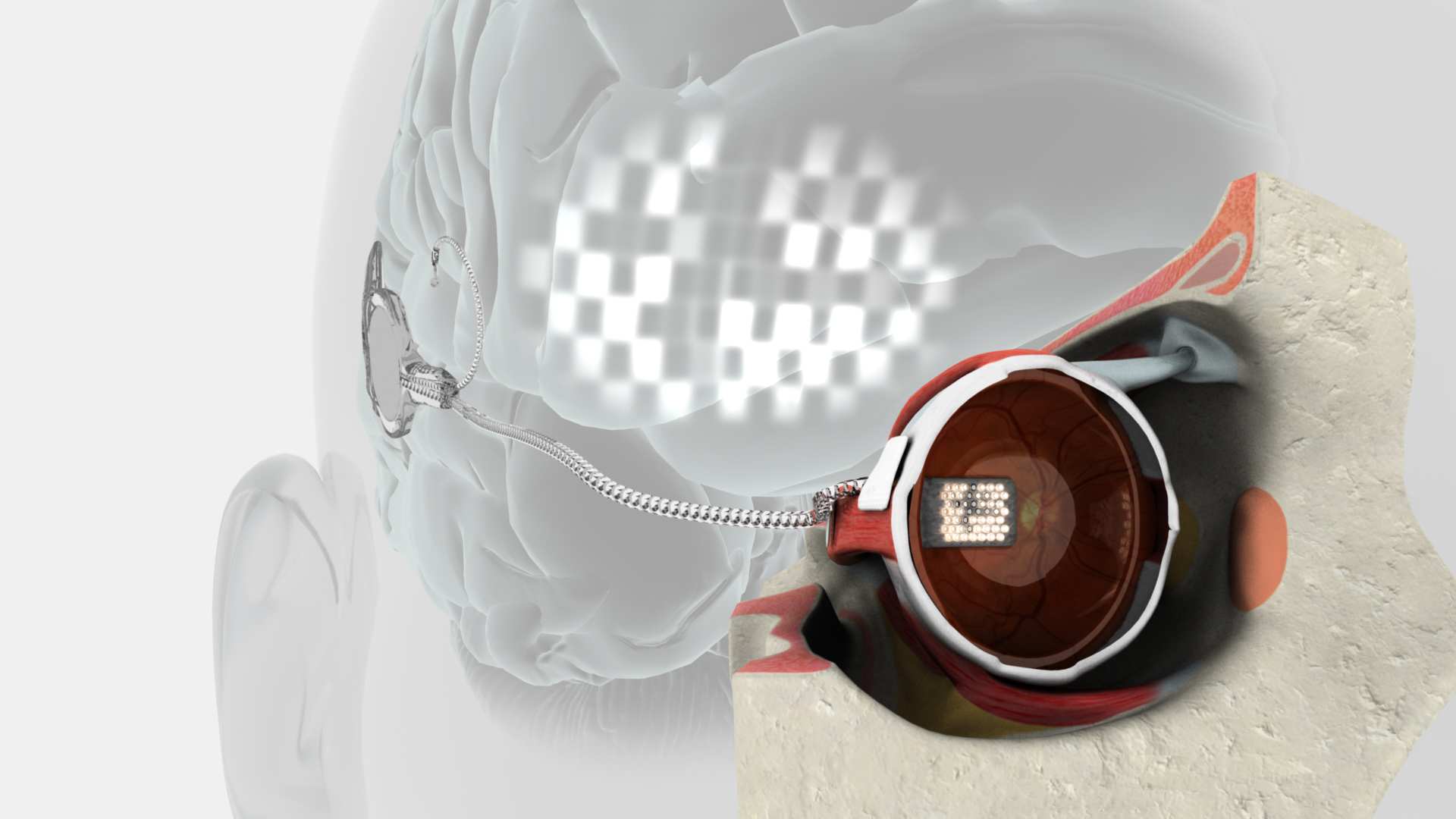 Bionic Bodies part 2 of 2 - ABC Radio National