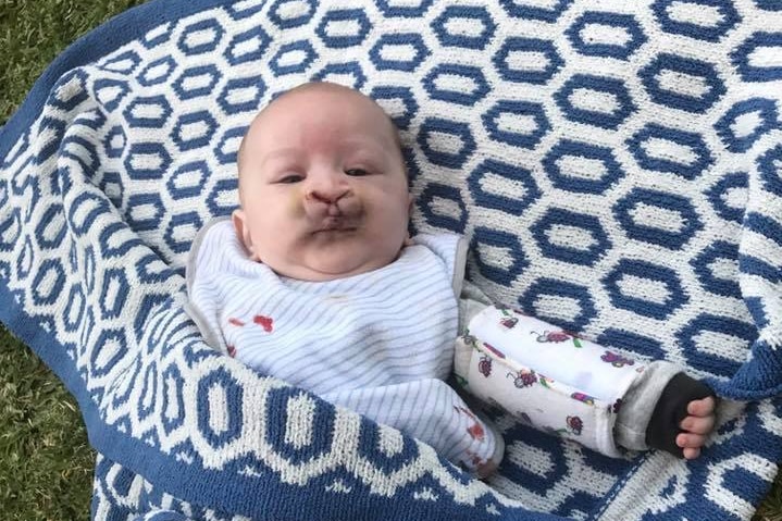 Charlie laying on a rug with bruising around his nose.