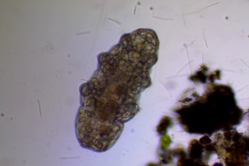 A small tardigrade is seen through a microscope