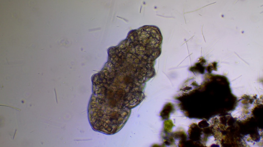 A small tardigrade is seen through a microscope