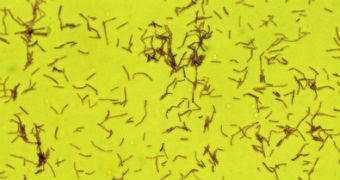 A microscopic image of lactobacillus acidophilus bacteria.