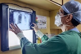 A man wearing a mask and a cap and dressed in scrubs stares at an x-ray of lungs.