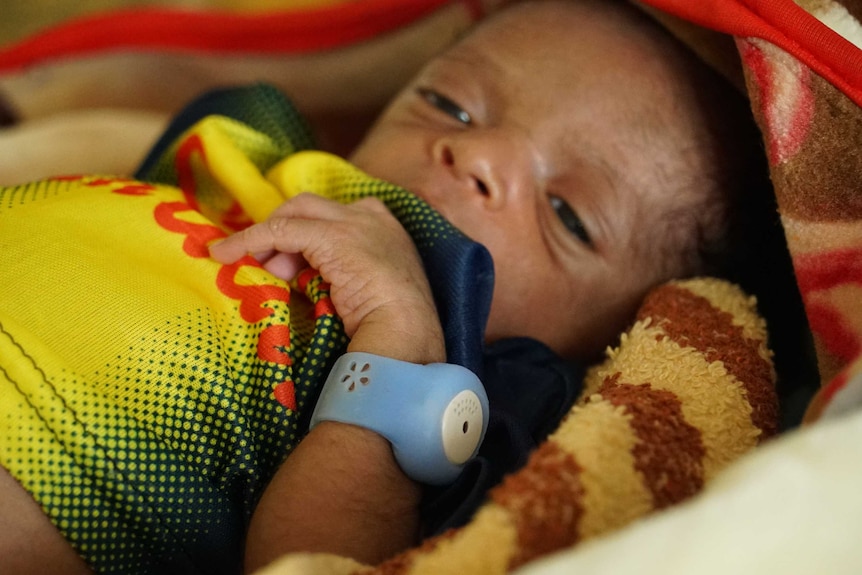 A small baby wears a large blue wristband which is monitoring its body temperature.