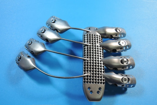 3D printed titanium ribcage and sternum