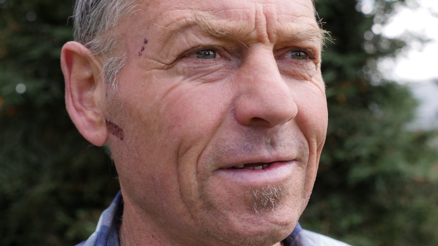 A close-up image of a man, with some recent scars on his face, who is talking about being homeless
