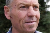 A close-up image of a man, with some recent scars on his face, who is talking about being homeless