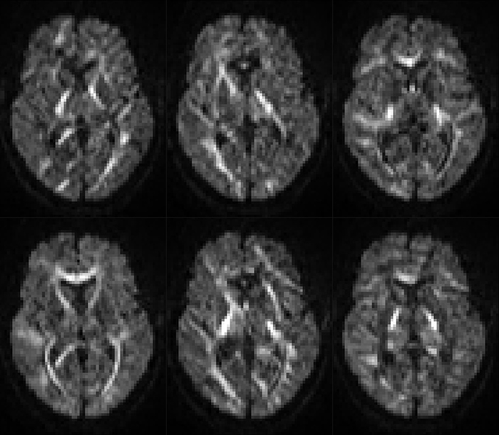 Six MRI images