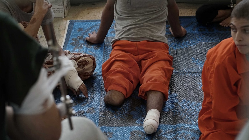 A man whose legs have been amputated sits on a prison floor.