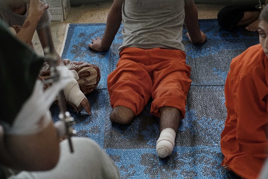 A man whose legs have been amputated sits on a prison floor.