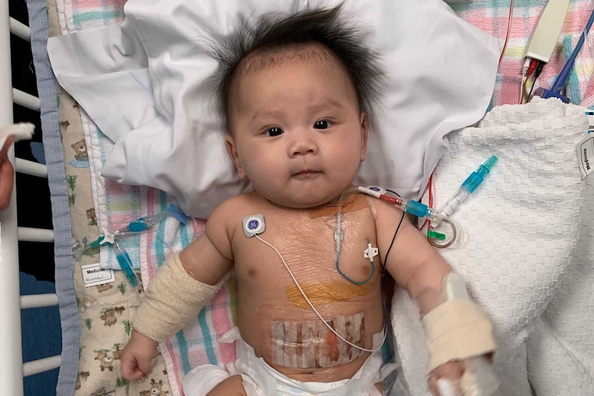 A baby in a hospital bed with leads attached