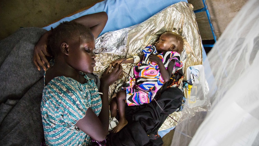 A young girl lies beside a malnourished infant on a intravenous drip in South Sudan.
