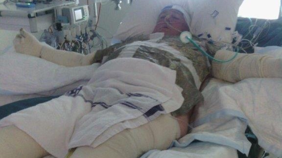 Man on hospital be with head, both arms and both legs bandaged