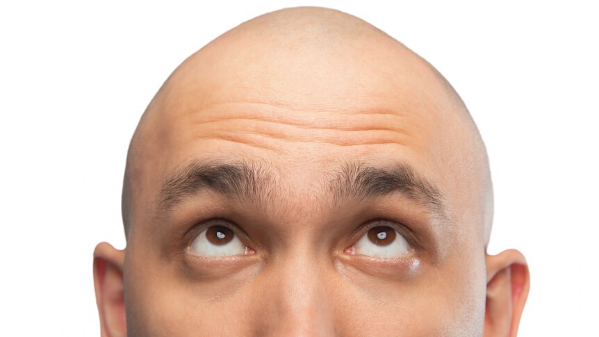 A bald man looks up at his head