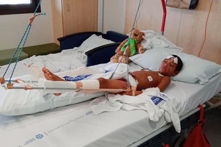 A photo of an injured five-year-old boy lying in a hospital bed.