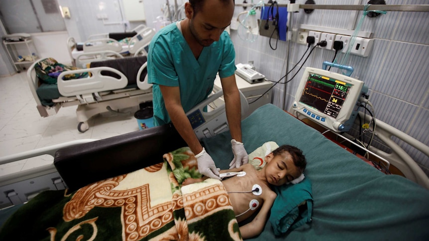 A nurse checks a boy at a hospital intensive care unit in Sanaa, Yemen September 27, 2016.