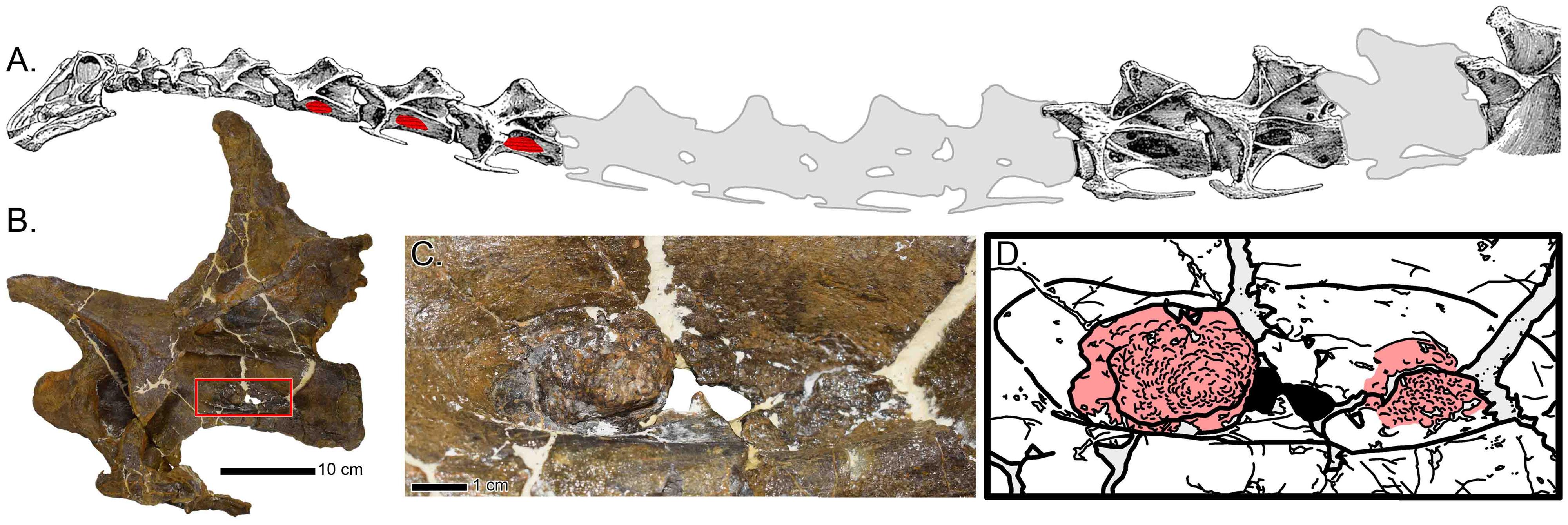 Illustration of spine, images of bone disease