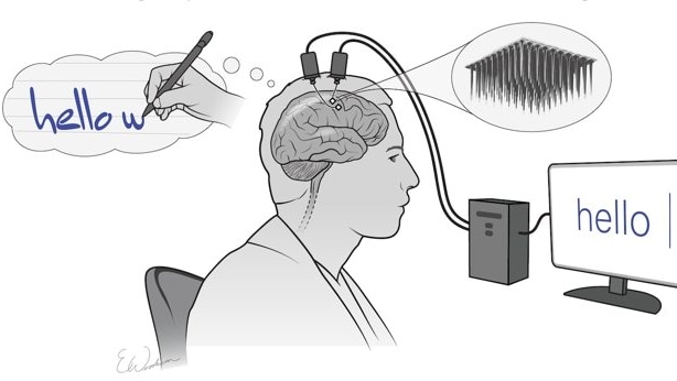 A diagram showing how the new brain implant can help turn thoughts into handwriting.