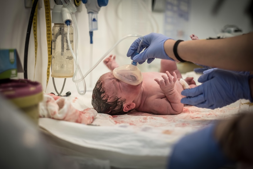 A tiny baby lying on a hosptal bed. Blue gloved hands hold an oxygen mask to their face. 