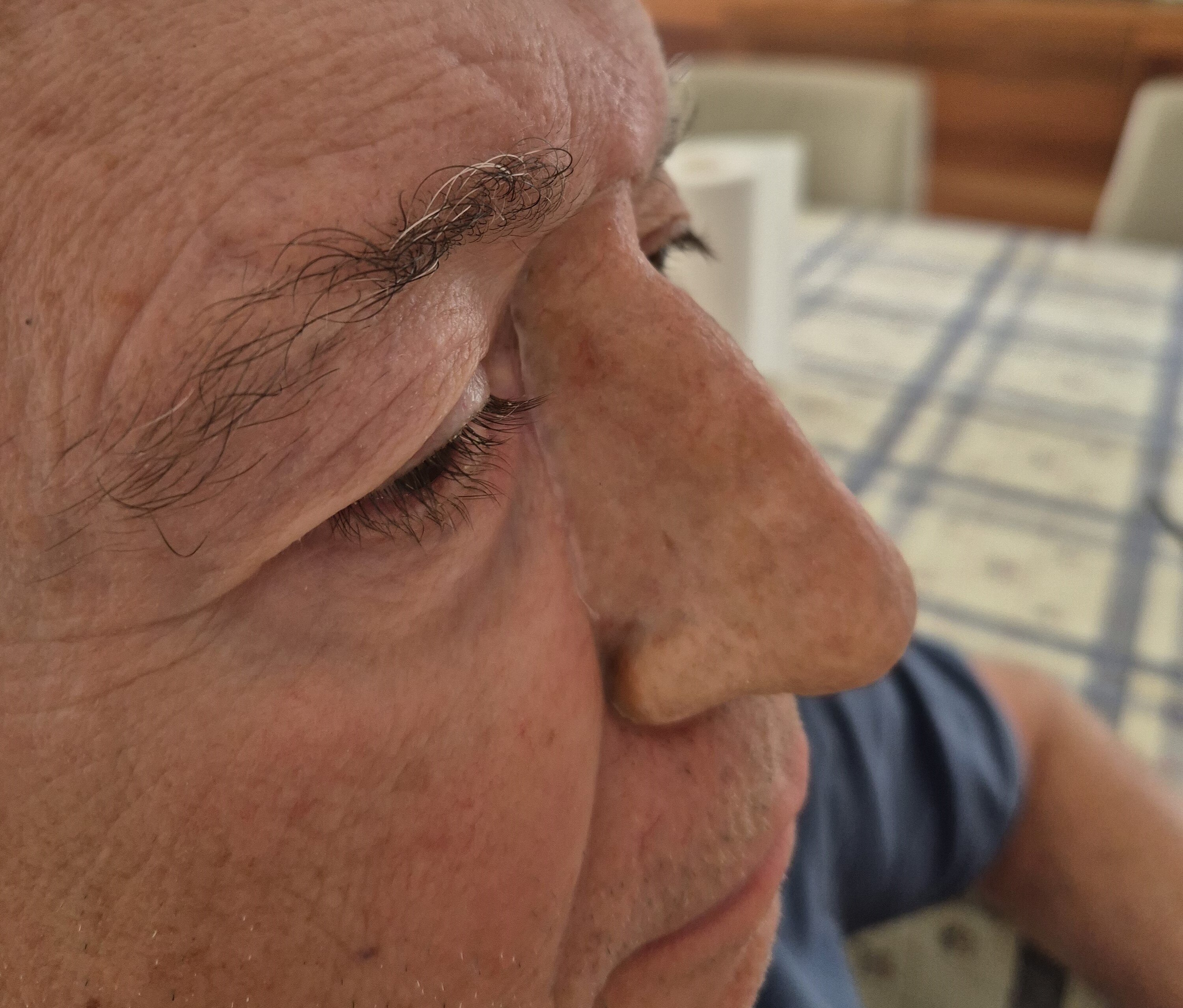 Close up of man with prosthetic nose