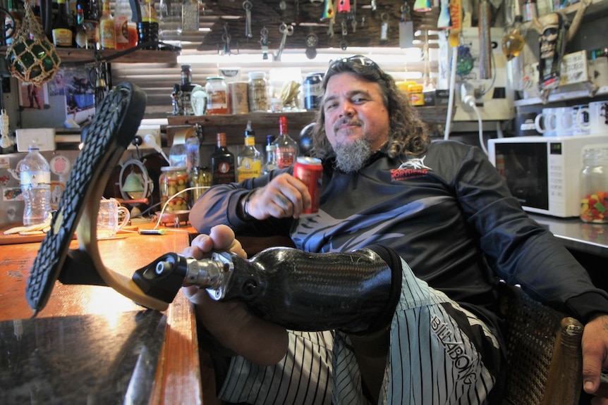 Man with his leg and prosthetic leg up on the bar while he leans back holding a beer 