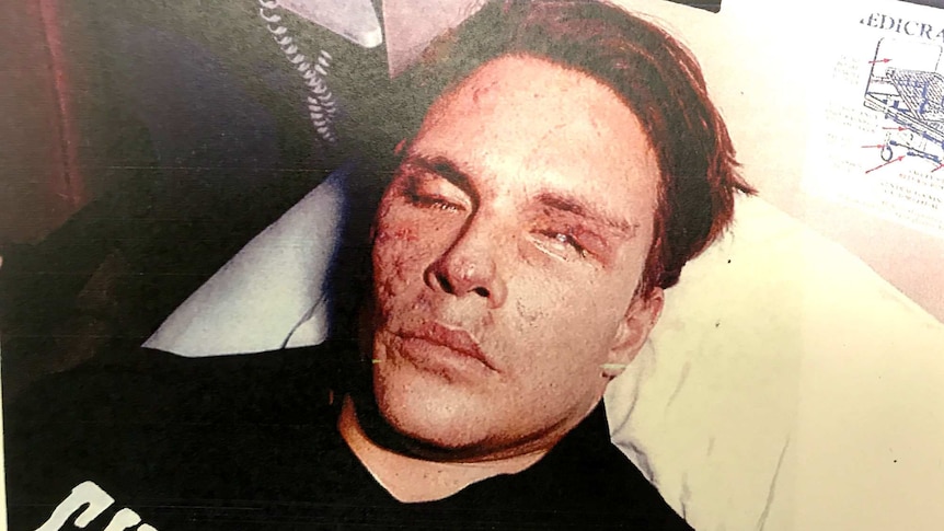 Brett Boyd lying in a hospital bed.