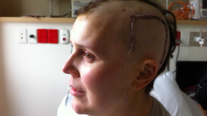 A large scar runs along the side of Melissa Sheldon's head