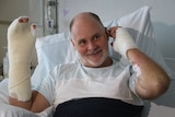 Craig Dickmann with bandaged hands and right arm smiles as he lies in a hospital bed.