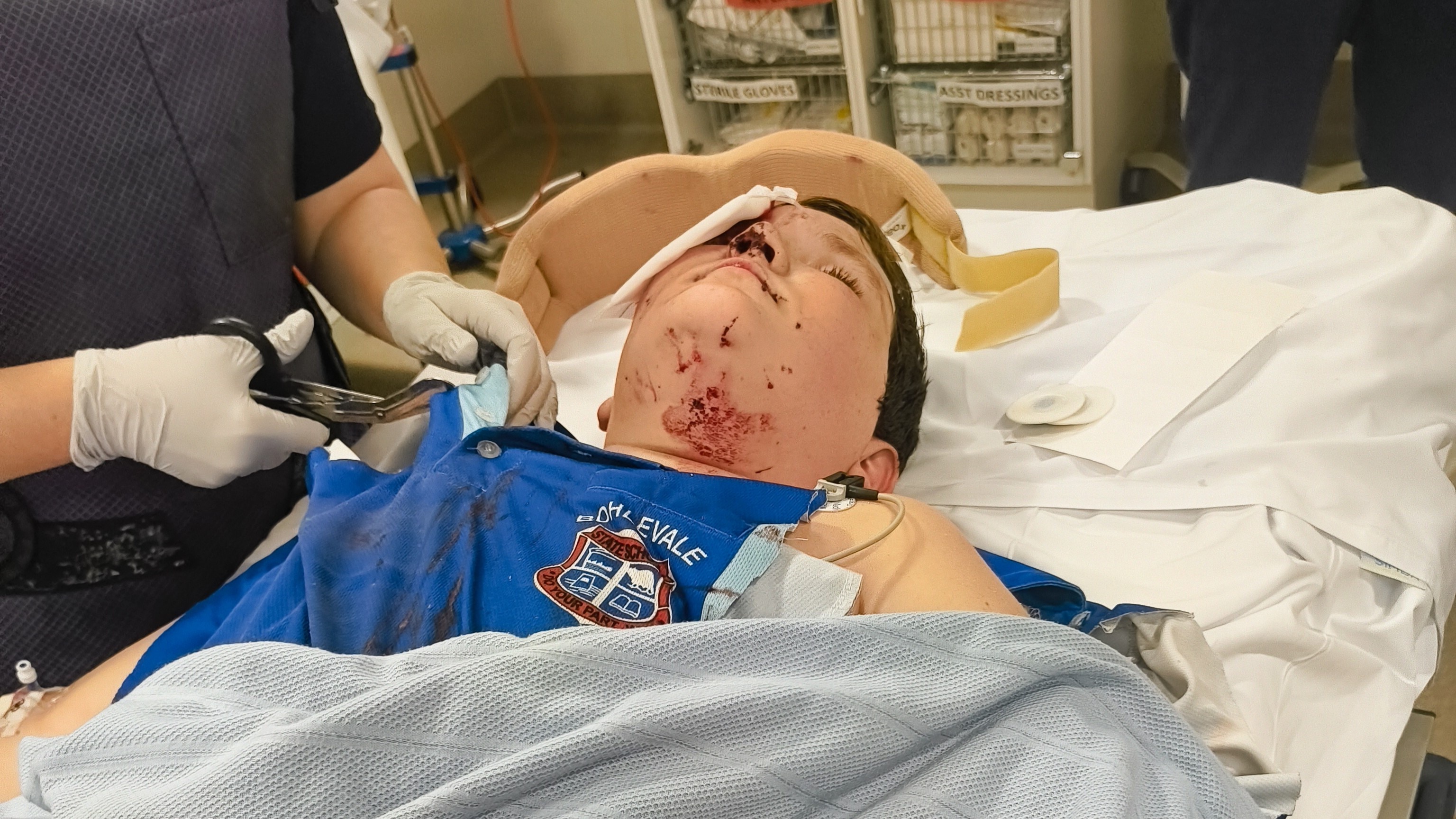 Boy left with broken eye socket after being hit by e-scooter