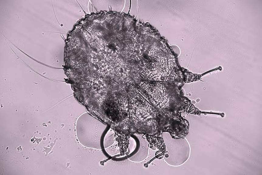 Scabies mite magnified.