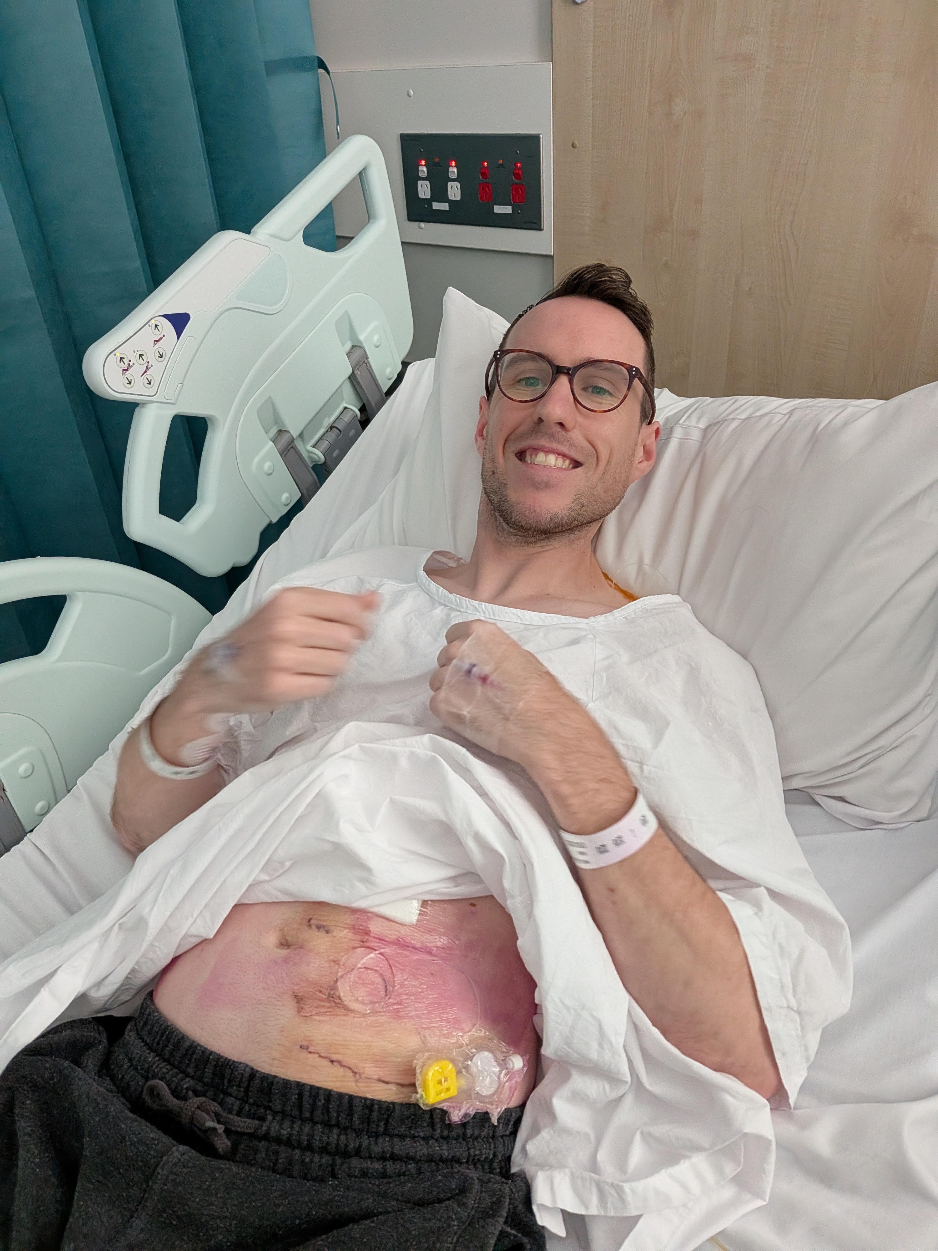 How effective altruism inspired Hu to give up his kidney and his cash