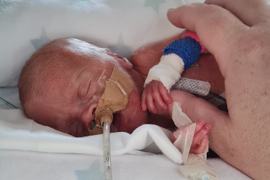 An adult hand touches the wrist of a tiny premature baby Levi 12 hours after being born in a Darwin hospital in 2022.