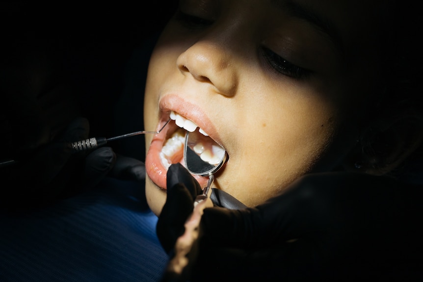 Close up of a person's mouth with dental tools, for a story on how often you need to visit the dentist. 