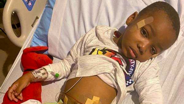 A small African American boy in a hospital bed with bandaids and tubes across his abdomen