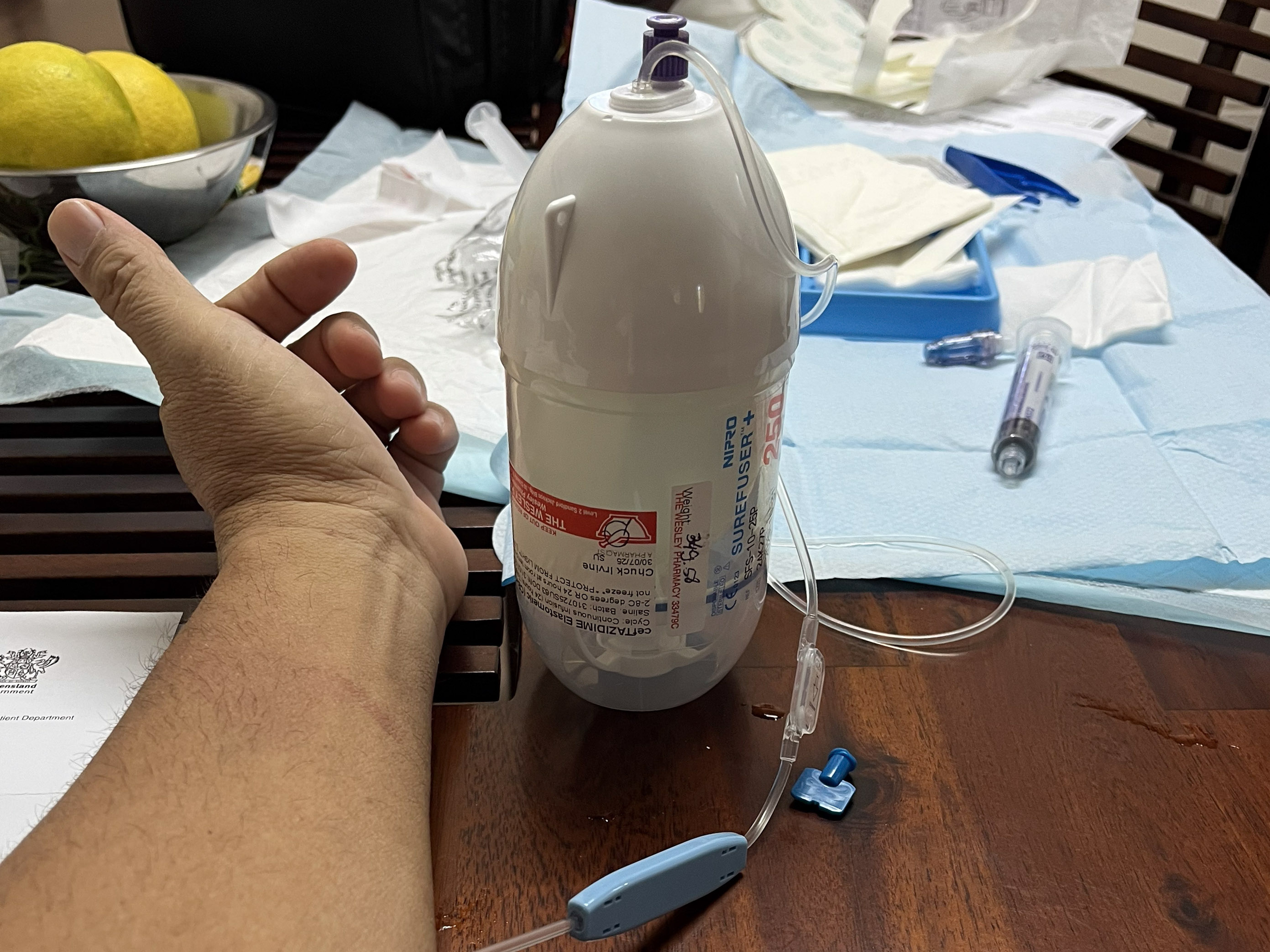 una botella con tubos junto a la mano de un hombre.