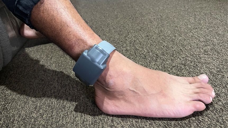 an image of a person's foot wearing an electronic monitoring ankle bracelet