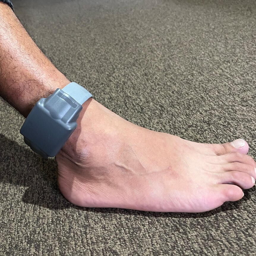 an image of a person's foot wearing an electronic monitoring ankle bracelet