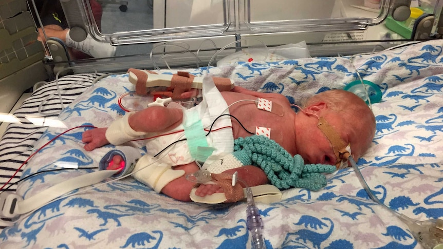 A premature baby in a humidicrib attached to tubes with a crochet octopus next to him