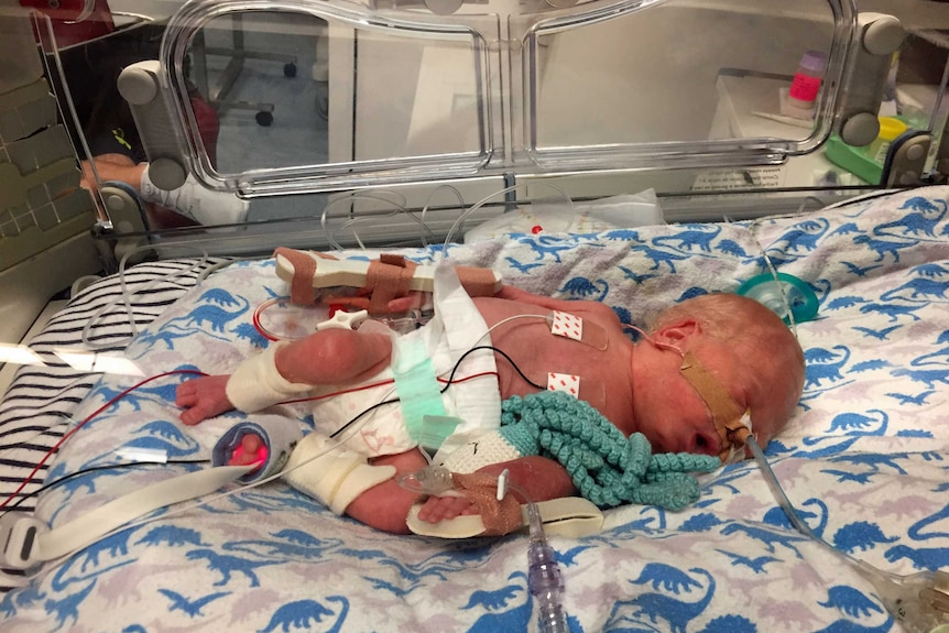 A premature baby in a humidicrib attached to tubes with a crochet octopus next to him