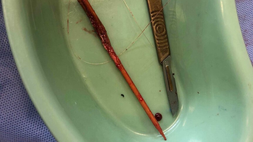 Skewer and scalpel in bowl.