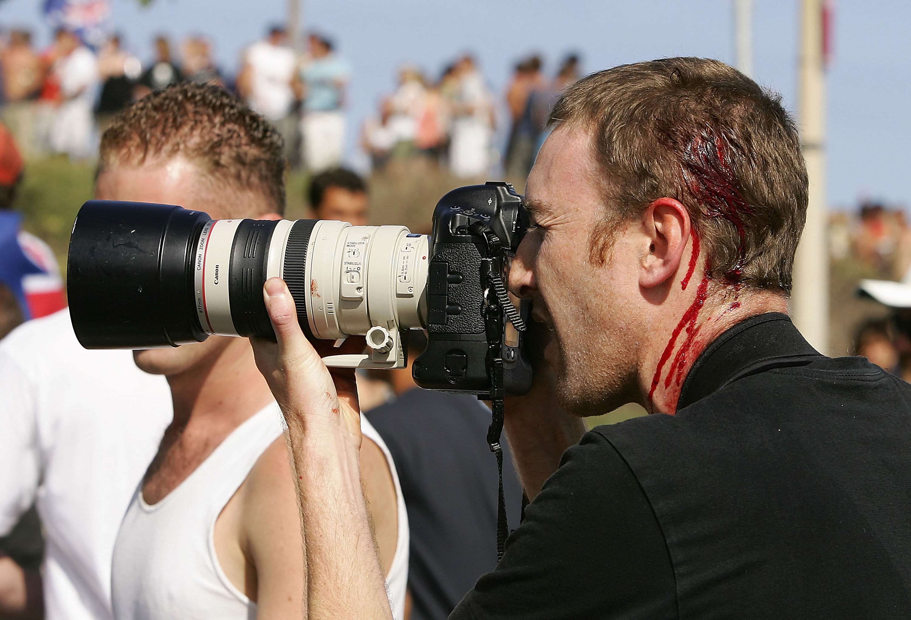 A photographer holds a camera with a long lens up to his eye amid a crowd of people while his head bleeds from a cut.