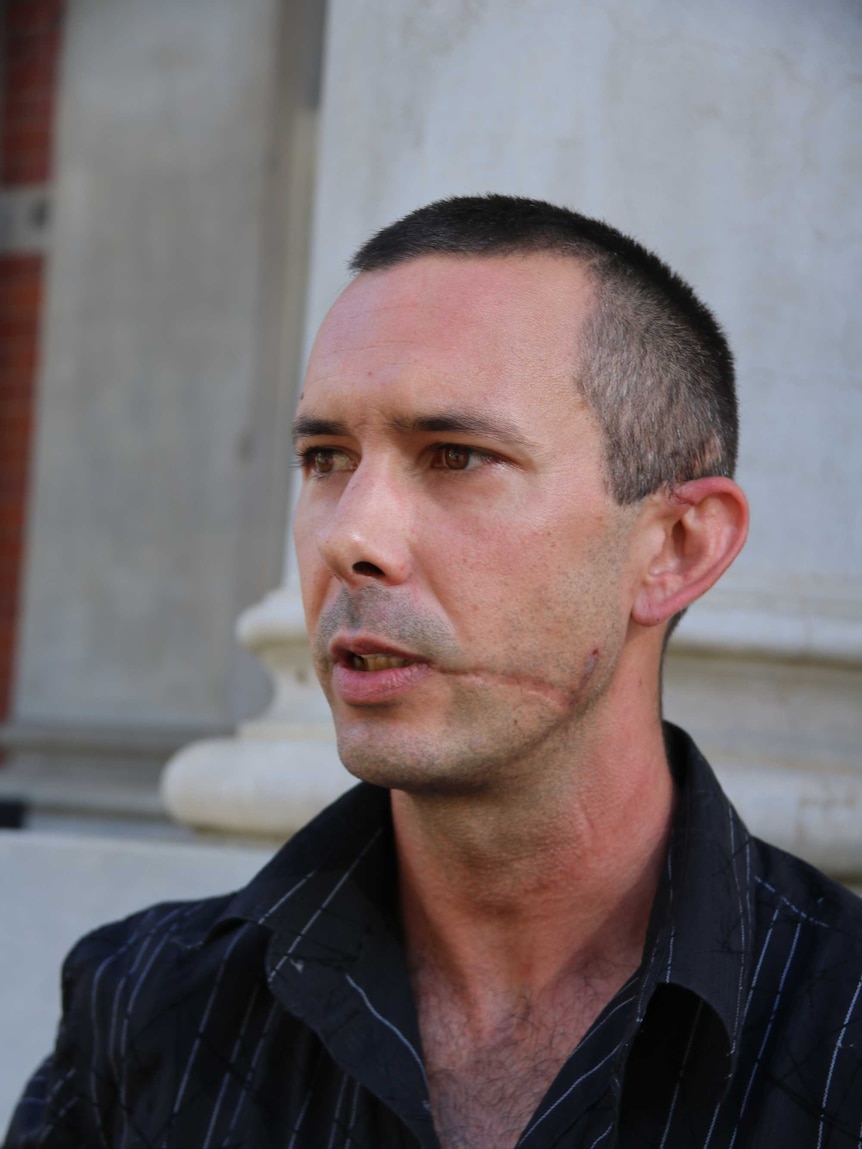 A man with a large scar on the side of his face speaks outside court.