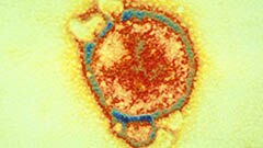 Hendra virus under the microscope