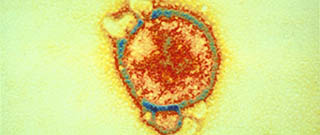 Hendra virus under the microscope