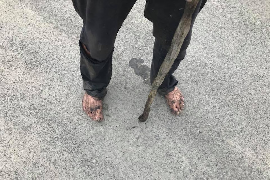 Brian Duncan's feet all muddy and dirty