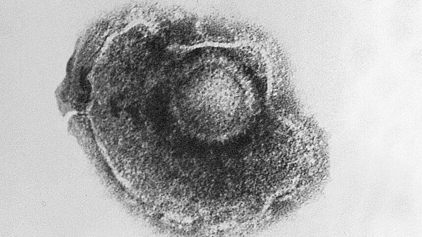 A black and white image of a varicella virus cell