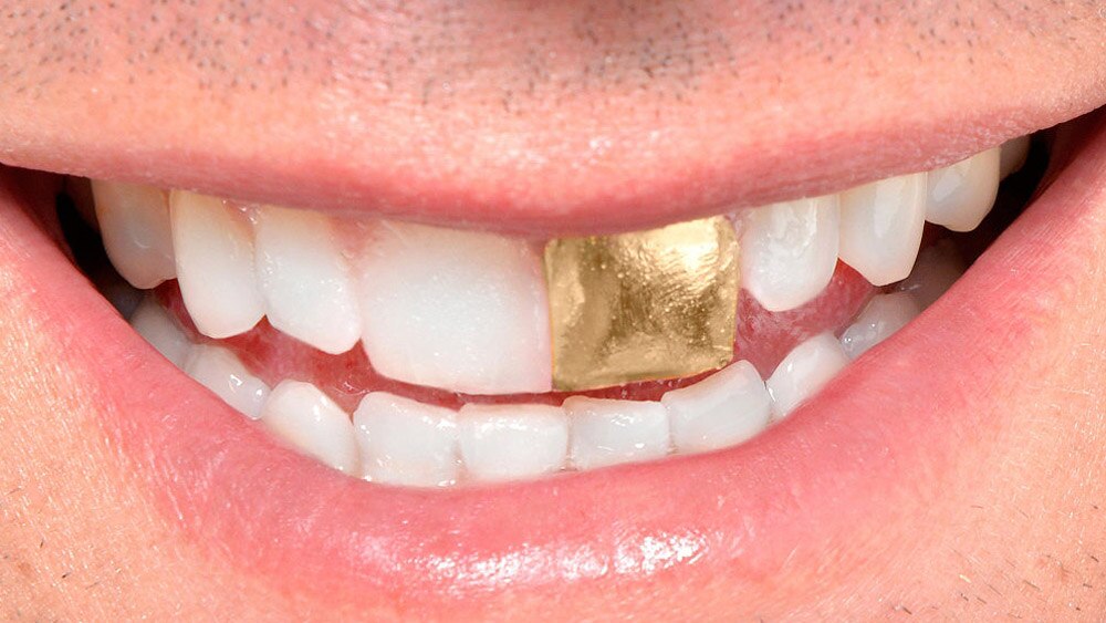 DOG ACTS: To gold tooth or not to gold tooth? - triple j